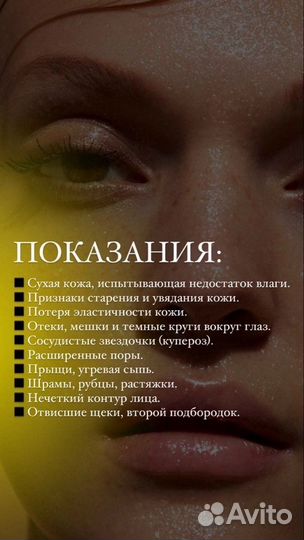 Холодная плазма