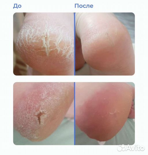 Маникюр, педикюр, наращивание, +подолог