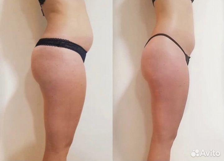 Массаж и коррекция фигуры