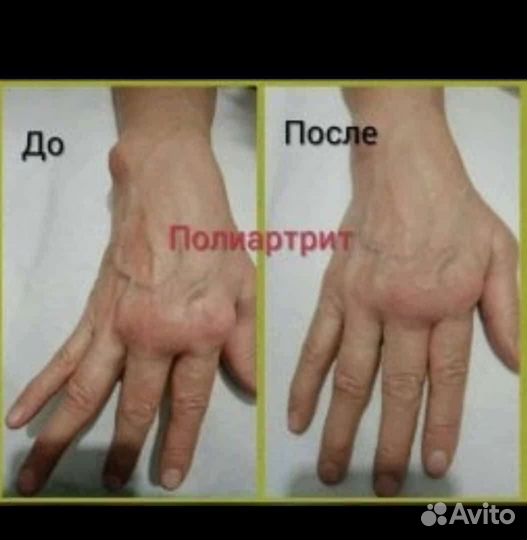 Биоэнергетический массаж Fohow