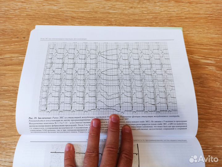 Медицинская литература. экг