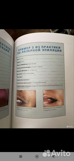 Энциклопедия лазернаяэпиляция,электроэпиляция