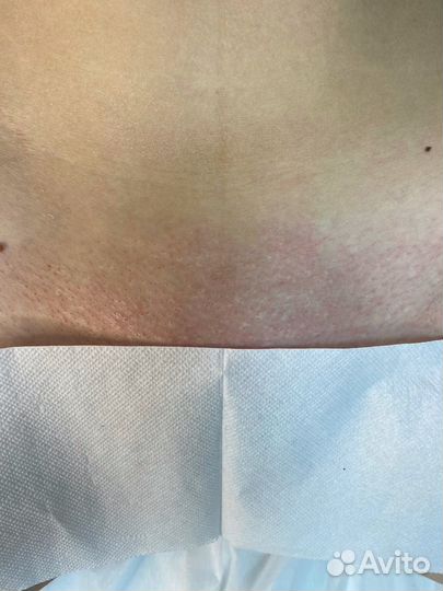 Модель на депиляцию