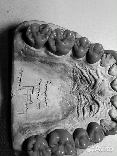 Услуги зубного техника