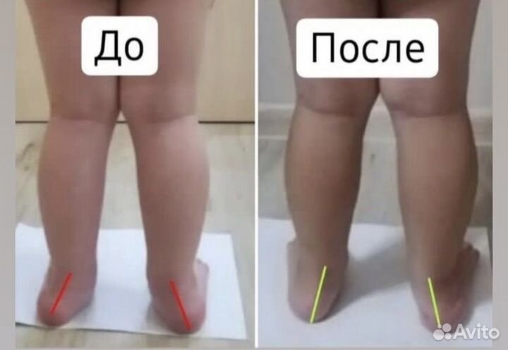 Детский массаж на дому/коррекция осанки