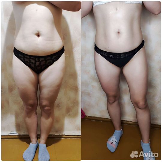 Антицеллюлитный (женский) массаж