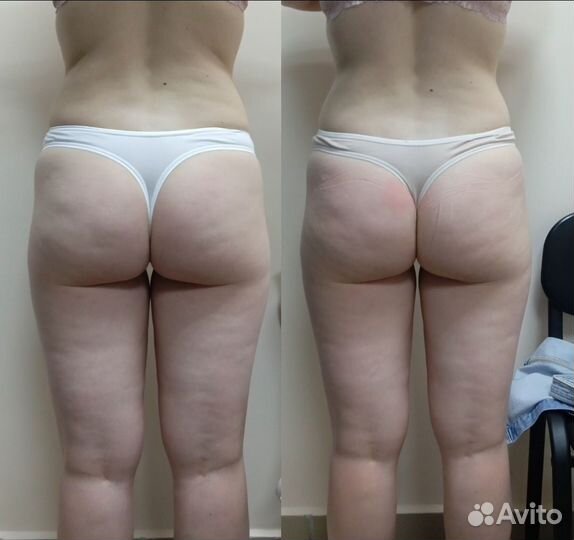 Ручная и Аппаратная коррекция лица и фигуры