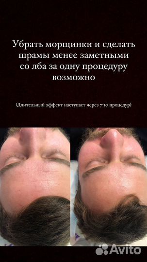 Массаж лица и тейпирование
