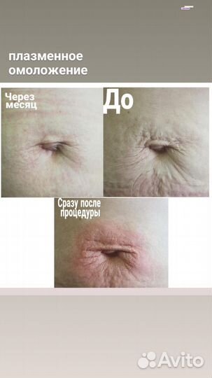 Горячая плазма