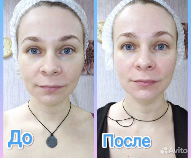 Массаж лица (омолаживающий)