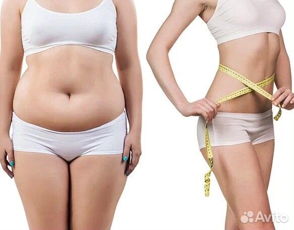 Криолиполиз - убирает жир в разных участках тела