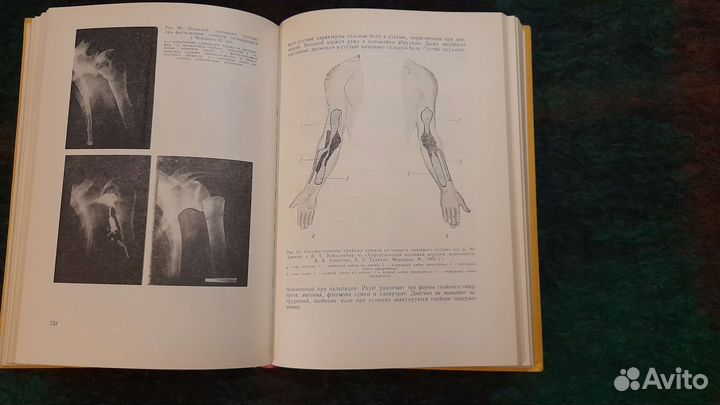 Медицинская литература: гнойная хирургия