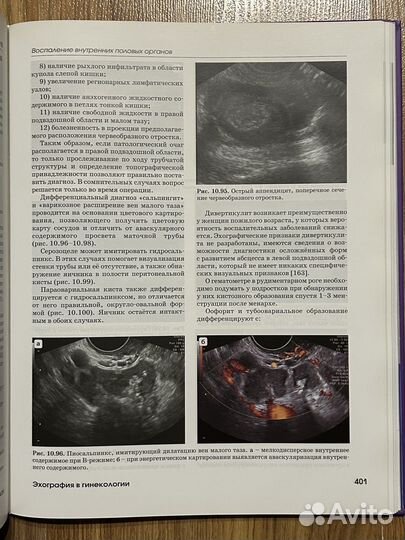 Эхография в гинекологии Озерская