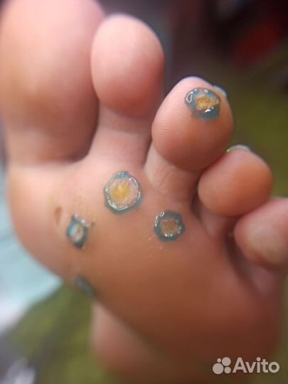 Услуги подолога, мужской педикюр