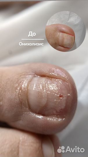 Услуги подолога