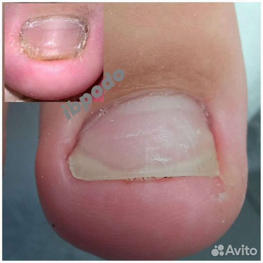 Аппаратный маникюр