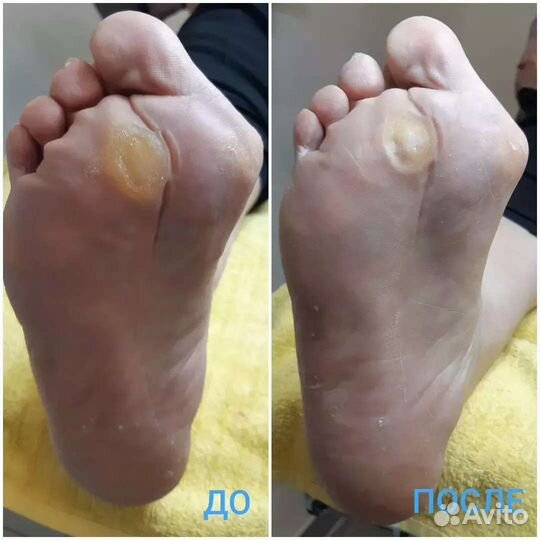 Услуги подолога