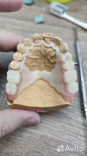 3d моделирование каркасов бюгельных протезов