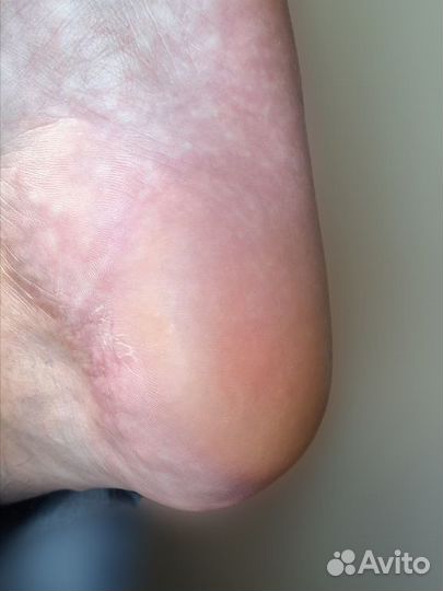 Мужской маникюр и педикюр