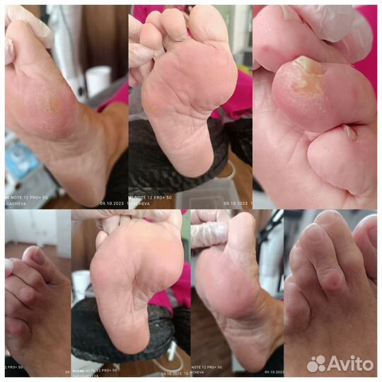 Услуги подолога