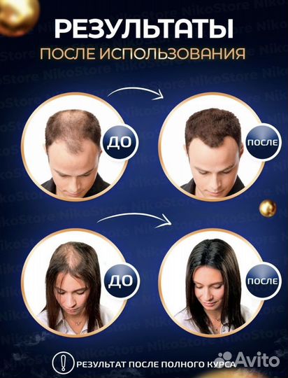 Миноксидил 5 - для роста бороды и волос