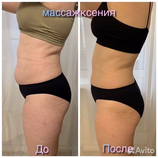 Аппаратная коррекция фигуры