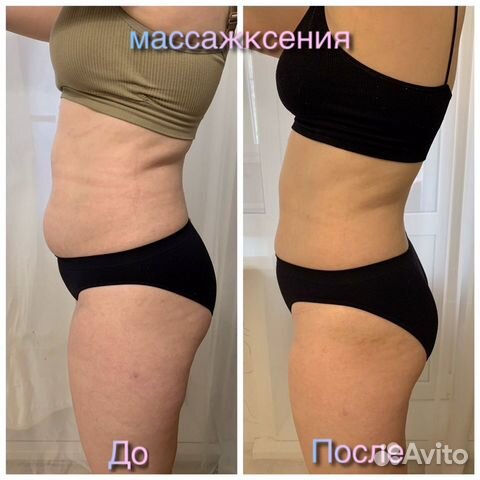 Аппаратная коррекция фигуры