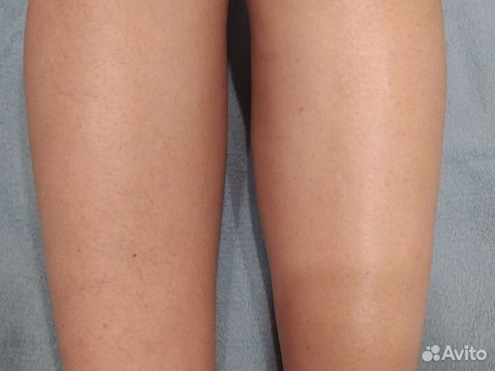 Депиляция воском: подмышки