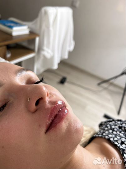 Увеличение губ безыгольно