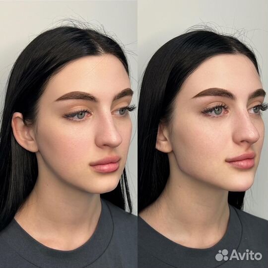 Косметолог: Профиль Джоли, скулы, губы, подбородок