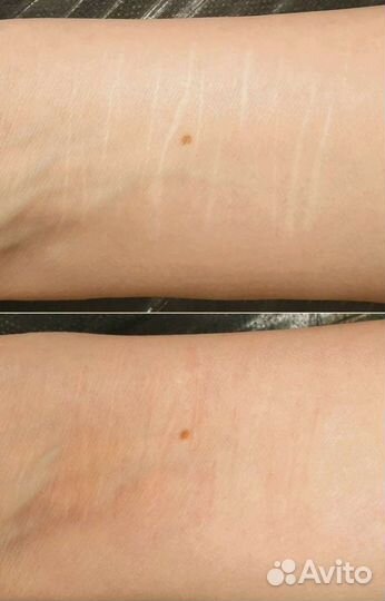 Перманент брови губы межресничка