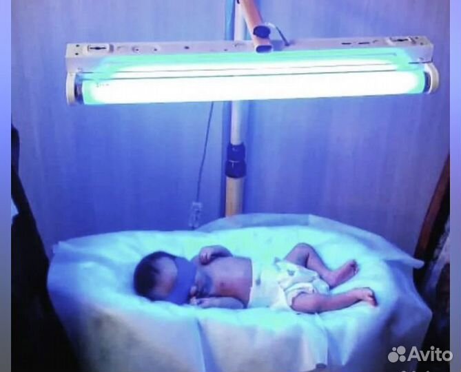 Проkaт Лампа лечение желтушки