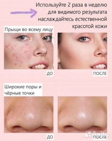 Вакуумный аппарат для чистки лица