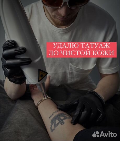 Лазерное удаление тату и татуажа бровей