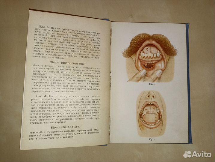 Карманный медицинский атлас т. 5. Болезни рта.1895