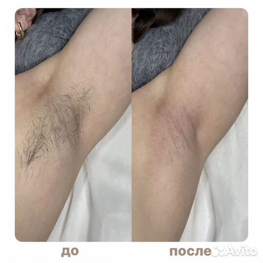 Депиляция Воск Шугаринг / Нюр / Новоюжка