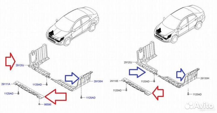 Защита двигателя пыльник двигателя Hyundai Solaris