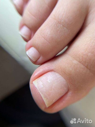 Педикюр smart