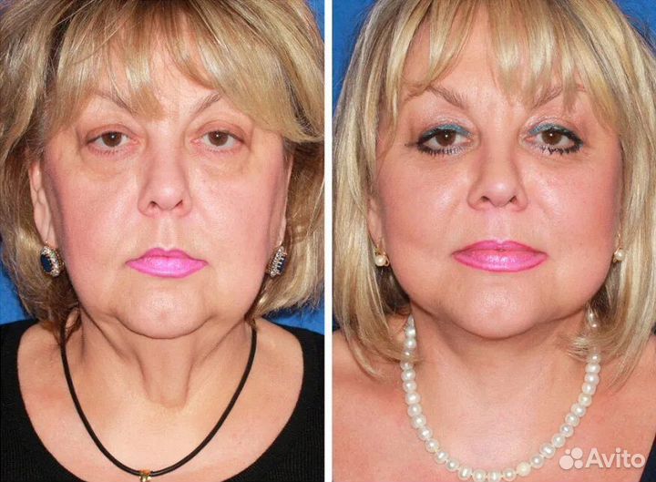 Массаж лица