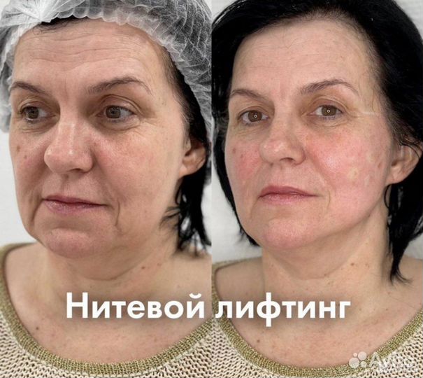 Консультация косметолога