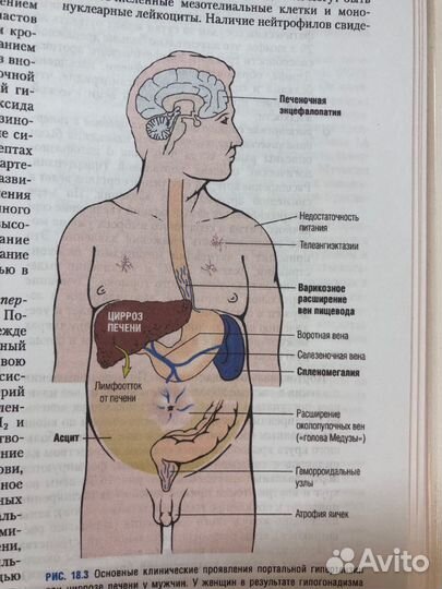 Основы патологии заболеваний по роббинсу и котрану