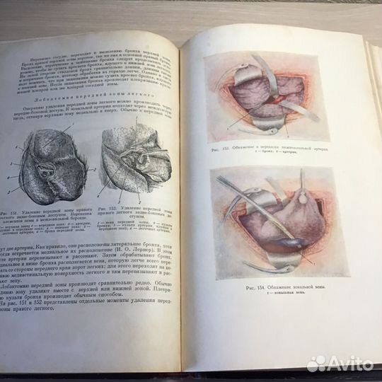 Хирургия органов грудной полости 1952г