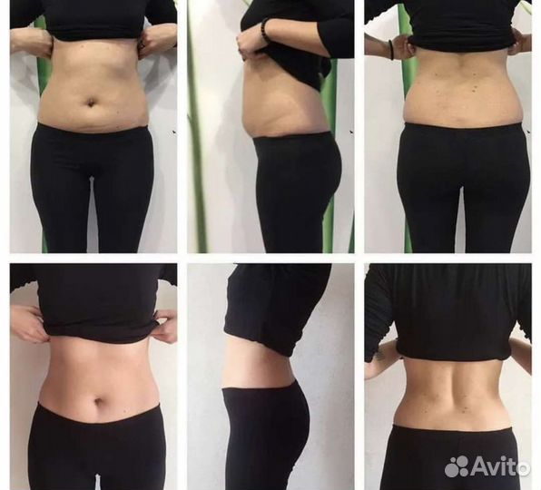 Похудение, жиросжигание с процедурой EMS