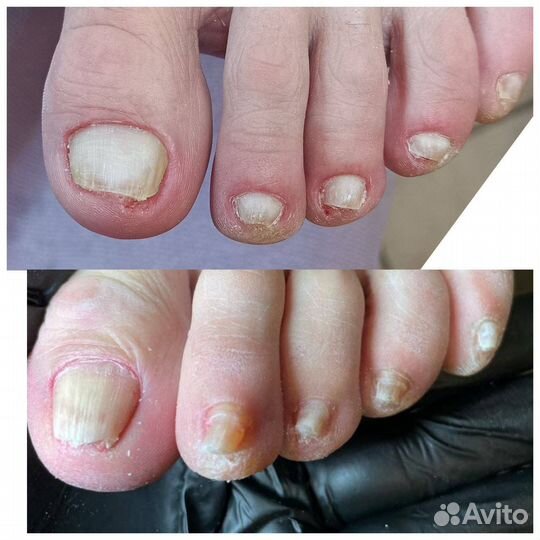 Услуги подолога