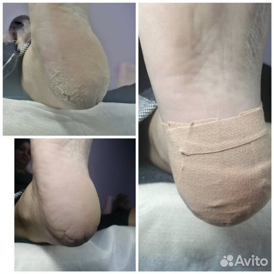 Маникюр, педикюр