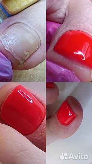 Маникюр педикюр