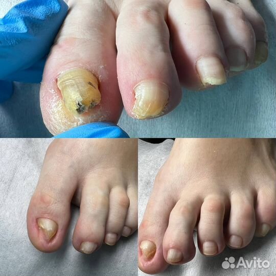 Подолог с выездом на дом