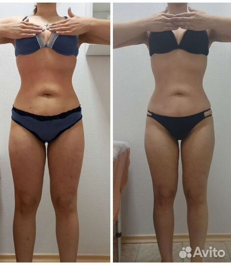 LPG массаж лица и тела на Комендантском проспекте