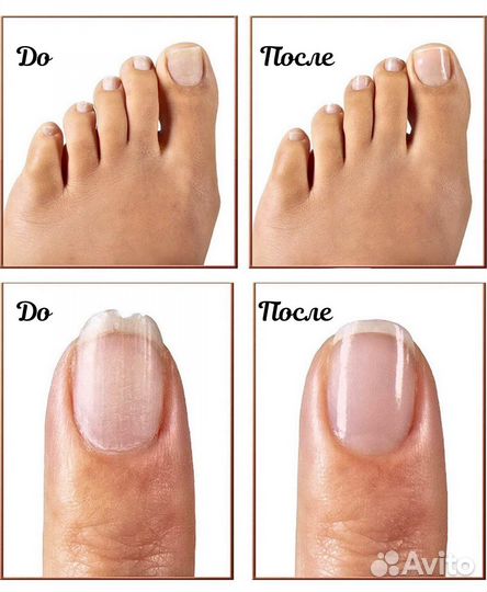 Аппарат для маникюра и педикюра