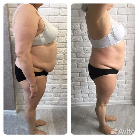 Мастер антицеллюлитного массажа